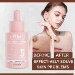 Age Defense Serum 5 in 1 bottle with anti-aging benefits, targeting fine lines, wrinkles, and skin elasticity.