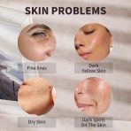 Age Defense Serum 5 in 1 bottle with anti-aging benefits, targeting fine lines, wrinkles, and skin elasticity.